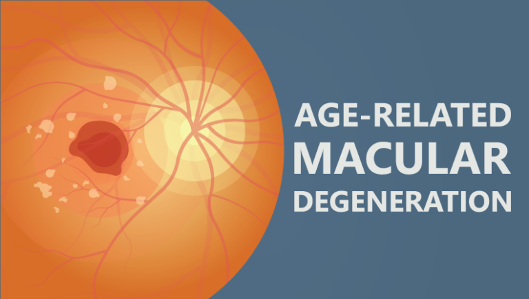Macula Month: Protect Your Sight This May